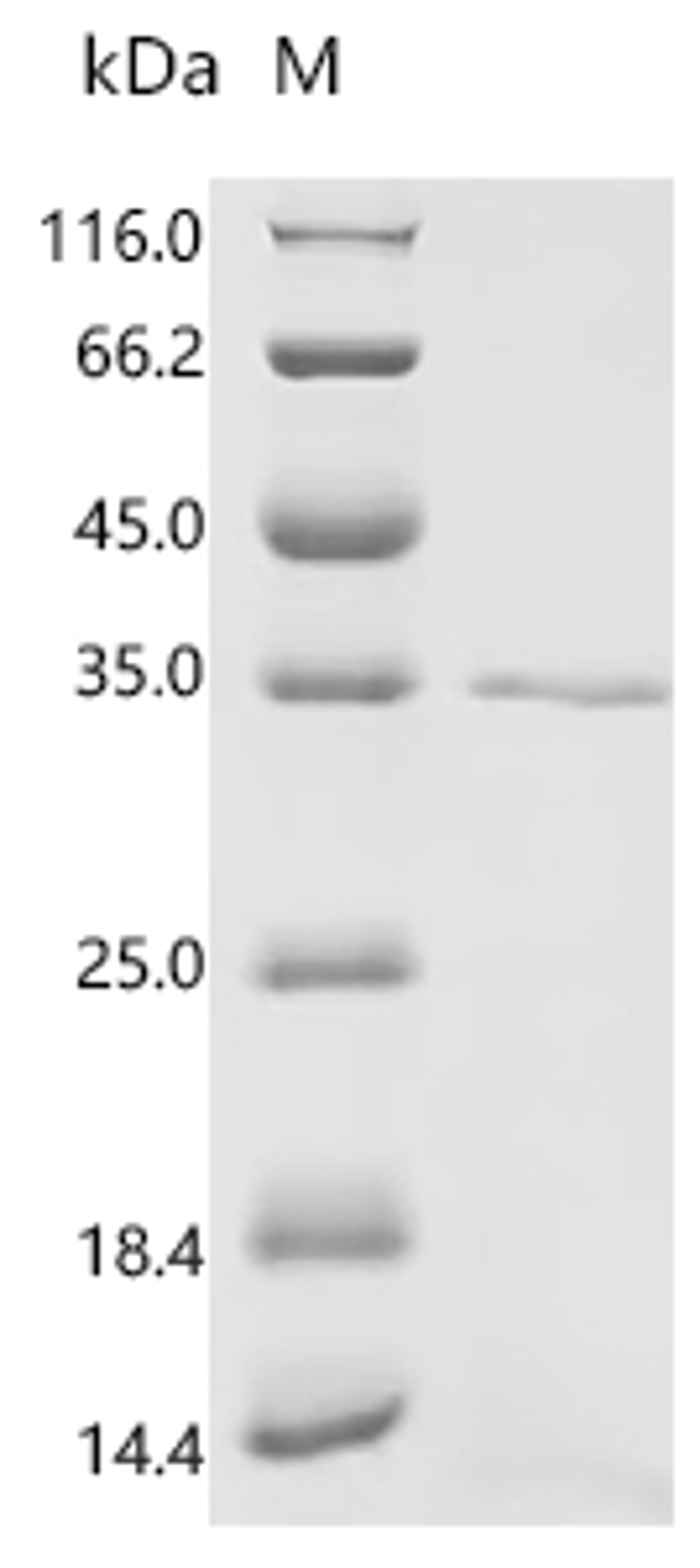 (Tris-Glycine gel) Discontinuous SDS-PAGE (reduced) with 5% enrichment gel and 15% separation gel.