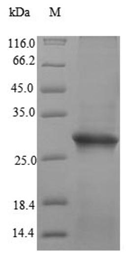 (Tris-Glycine gel) Discontinuous SDS-PAGE (reduced) with 5% enrichment gel and 15% separation gel.