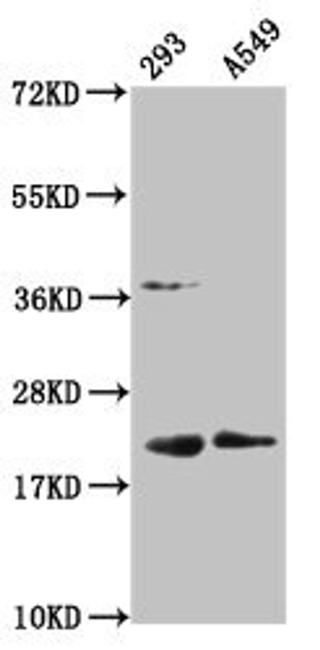Western Blot. Positive WB detected in: 293 whole cell lysate, A549 whole cell lysate. All lanes: HIST1H1C antibody at 1:100. Secondary. Goat polyclonal to rabbit IgG at 1/50000 dilution. Predicted band size: 22 kDa. Observed band size: 22 kDa