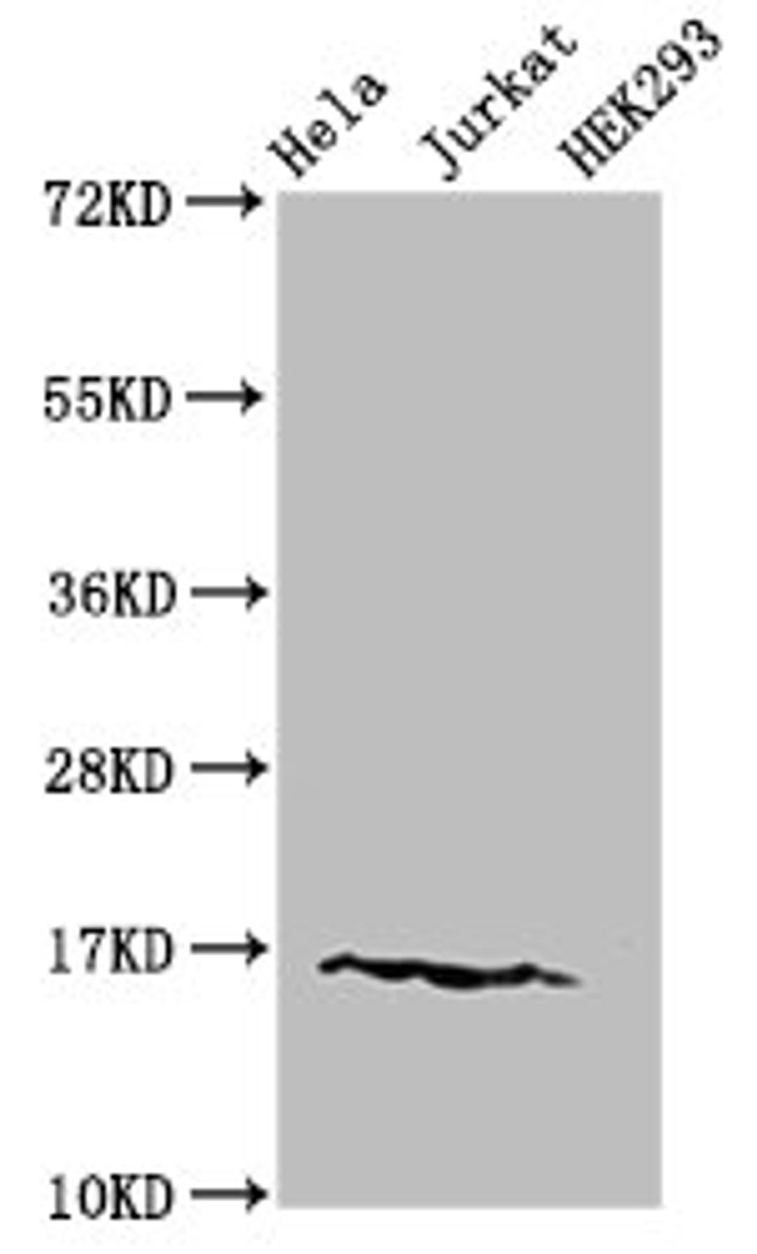 Western Blot. Positive WB detected in: Hela cell acid extracts, Jurkat cell acid extracts, HEK293 cell acid extracts. All lanes: HIST1H3A antibody at 1.5µg/ml. Secondary. Goat polyclonal to rabbit IgG at 1/50000 dilution. Predicted band size: 16 kDa. Observed band size: 16 kDa
