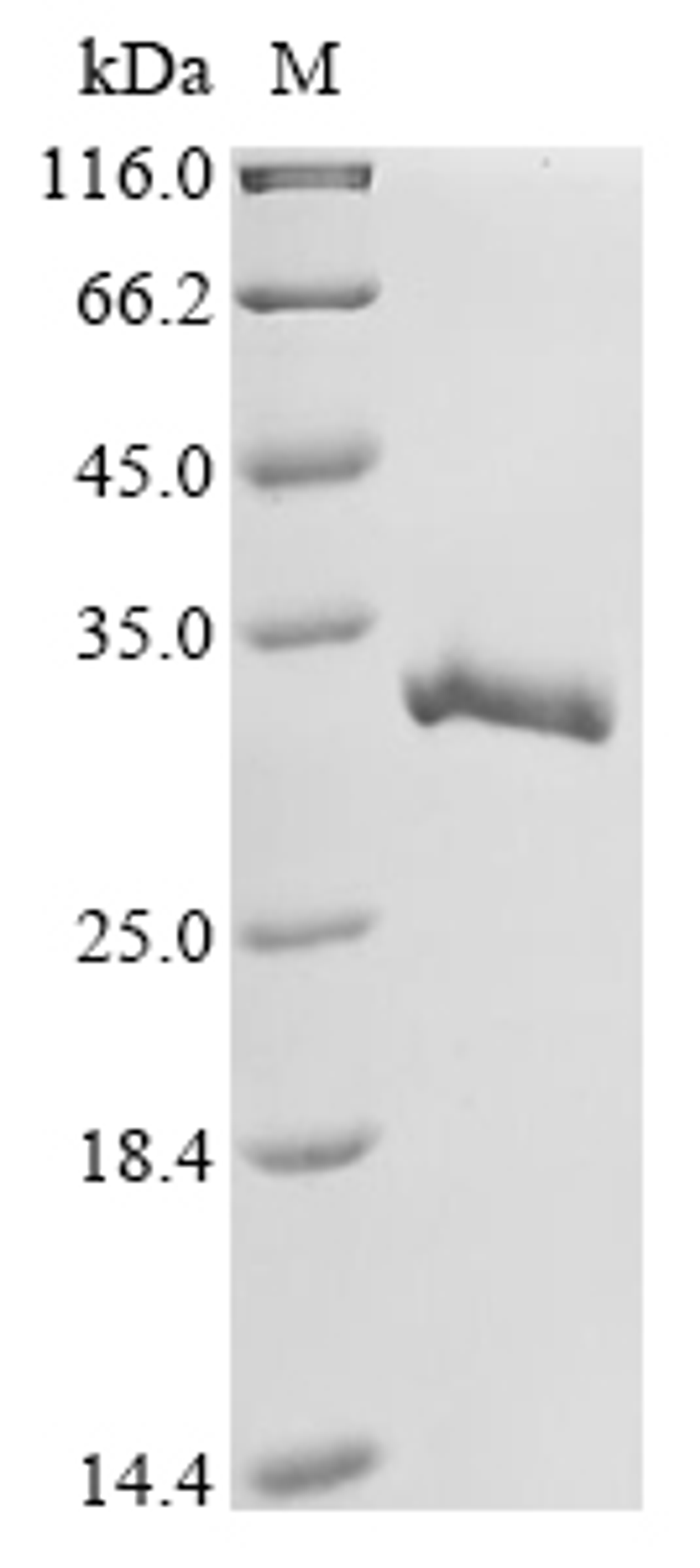 (Tris-Glycine gel) Discontinuous SDS-PAGE (reduced) with 5% enrichment gel and 15% separation gel.