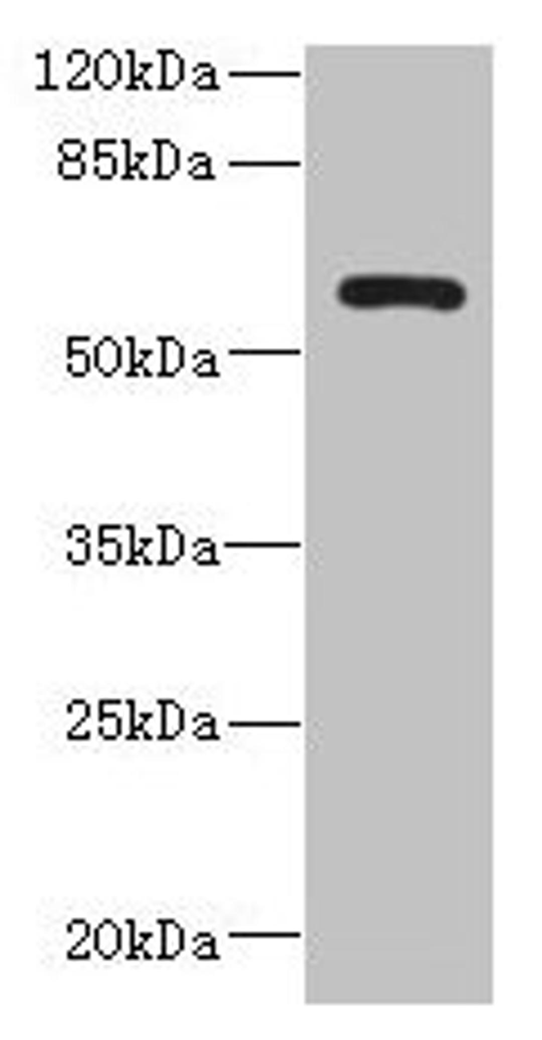 Western blot. All lanes: ZCCHC4 antibody at 0.6µg/ml + A431 whole cell lysate. Secondary. Goat polyclonal to rabbit IgG at 1/10000 dilution. Predicted band size: 60, 26, 59 kDa. Observed band size: 60 kDa