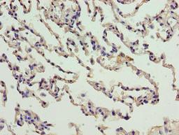Immunohistochemistry of paraffin-embedded human lung tissue using CSB-PA848394LA01HU at dilution of 1:100