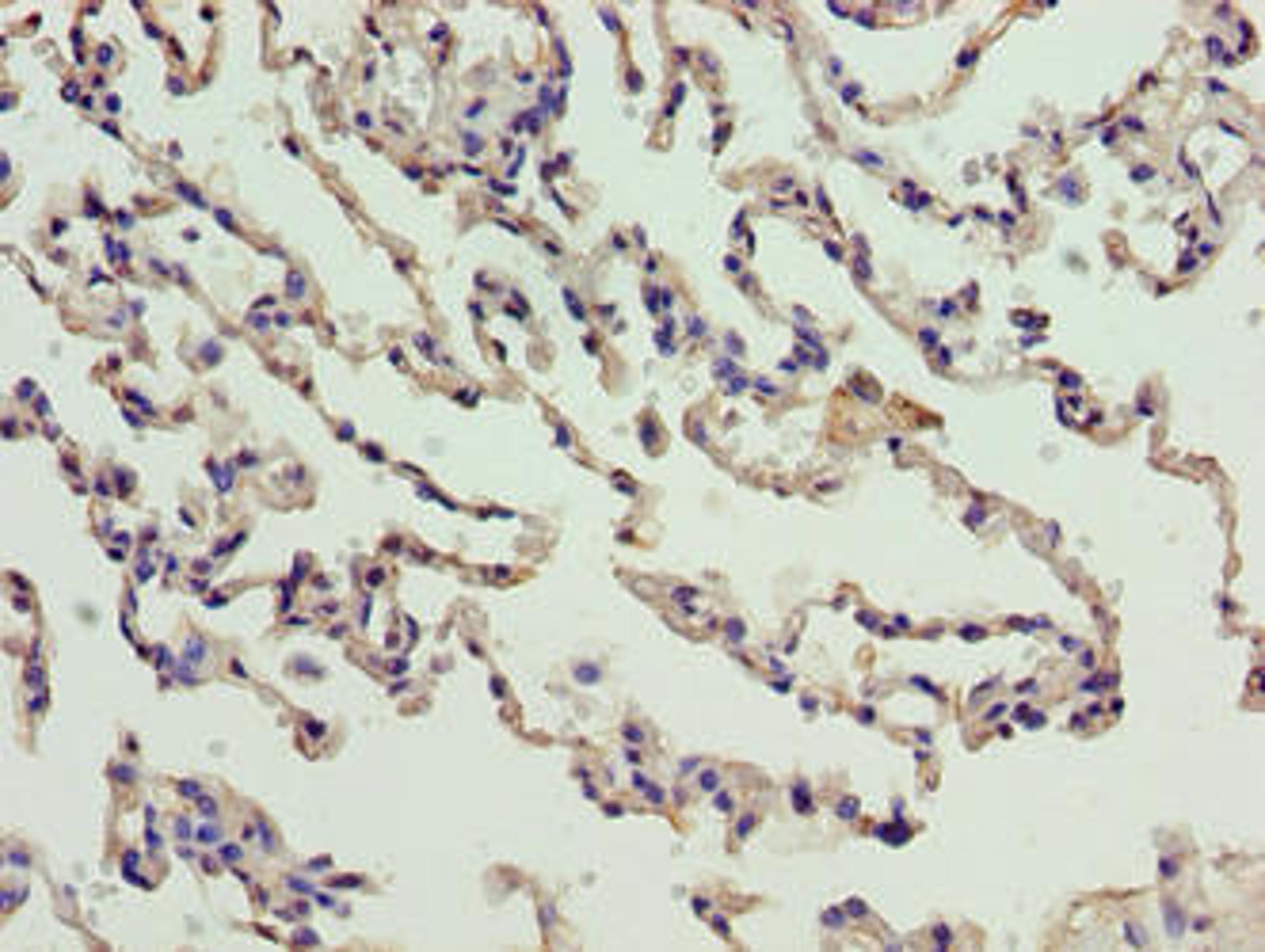 Immunohistochemistry of paraffin-embedded human lung tissue using CSB-PA848394LA01HU at dilution of 1:100