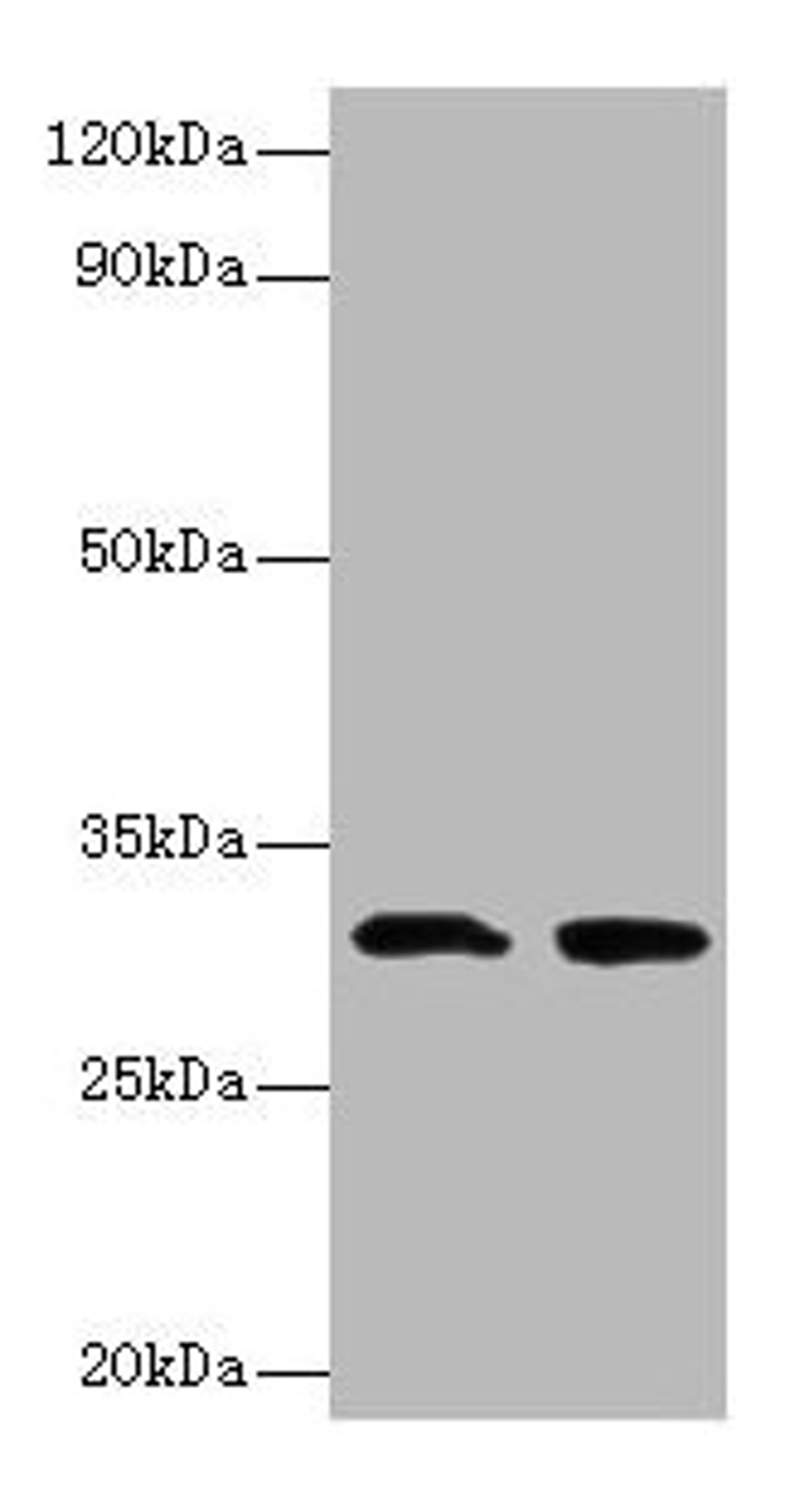Western blot. All lanes: IL1B antibody at 2µg/ml. Lane 1: Recombinant Interleukin-1 beta protein 0.05µg. Lane 2: Recombinant Interleukin-1 beta protein 0.5µg. Secondary. Goat polyclonal to rabbit IgG at 1/10000 dilution. Predicted band size: 31 kDa. Observed band size: 31 kDa