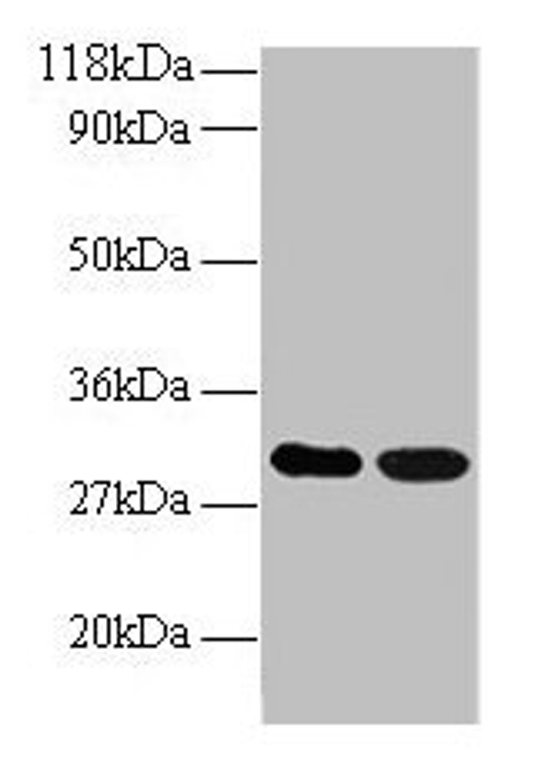 Western blot. All lanes: ARHGEF18 antibody at 2µg/ml. Lane 1: EC109 whole cell lysate. Lane 2: 293T whole cell lysate. Secondary. Goat polyclonal to rabbit IgG at 1/15000 dilution. Predicted band size: 131, 115 kDa. Observed band size: 30 kDa