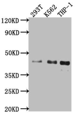 Western Blot. Positive WB detected in: 293T whole cell lysate, K562 whole cell lysate, THP-1 whole cell lysate. All lanes: Islet1 antibody at 1:1000. Secondary. Goat polyclonal to rabbit IgG at 1/50000 dilution. Predicted band size: 40 kDa. Observed band size: 40 kDa. 