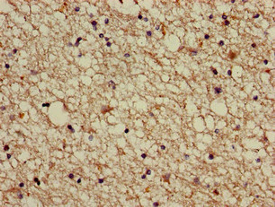 Immunohistochemistry of paraffin-embedded human brain tissue using CSB-PA001102LA01HU at dilution of 1:100