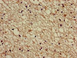 Immunohistochemistry of paraffin-embedded human brain tissue using CSB-PA001102LA01HU at dilution of 1:100