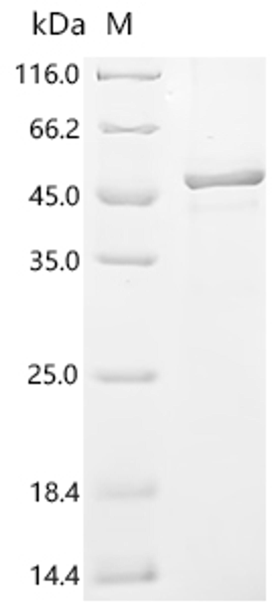 (Tris-Glycine gel) Discontinuous SDS-PAGE (reduced) with 5% enrichment gel and 15% separation gel.