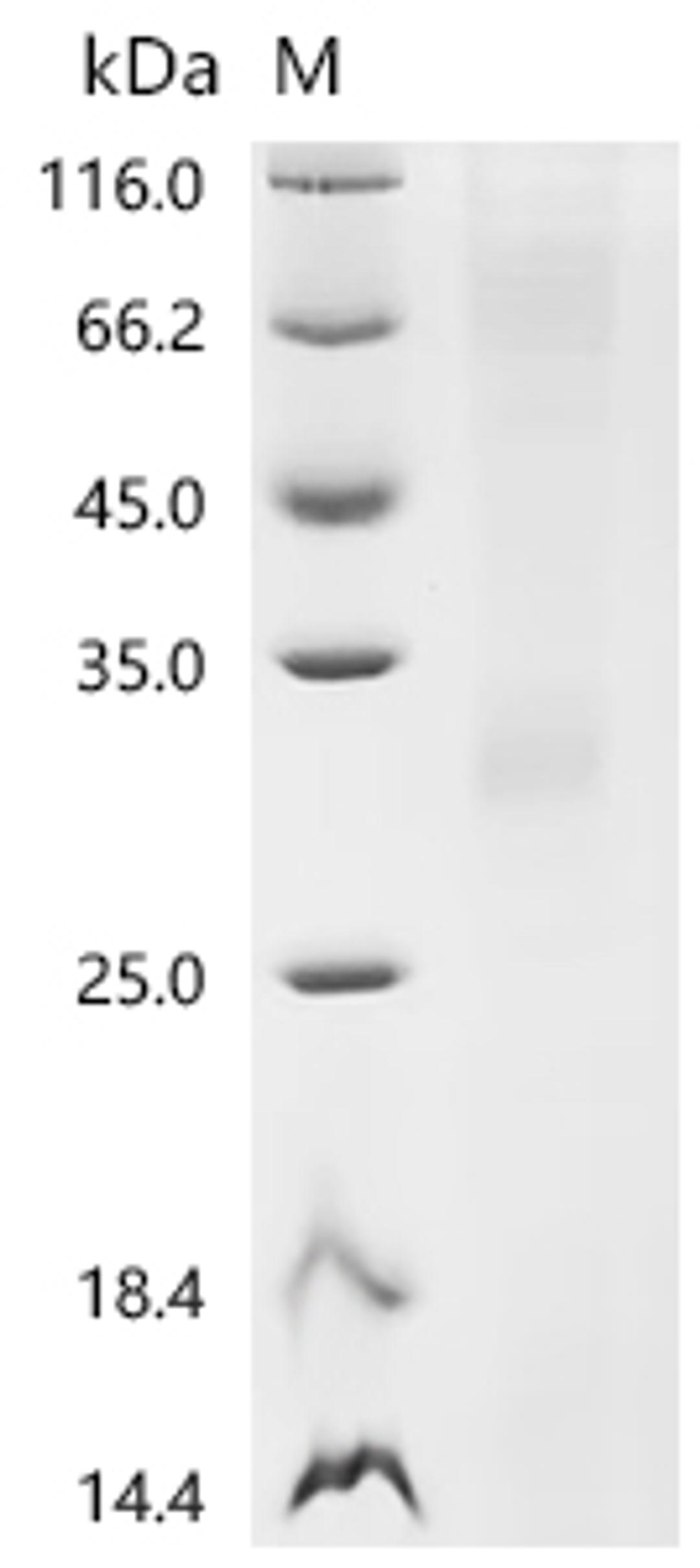(Tris-Glycine gel) Discontinuous SDS-PAGE (reduced) with 5% enrichment gel and 15% separation gel.