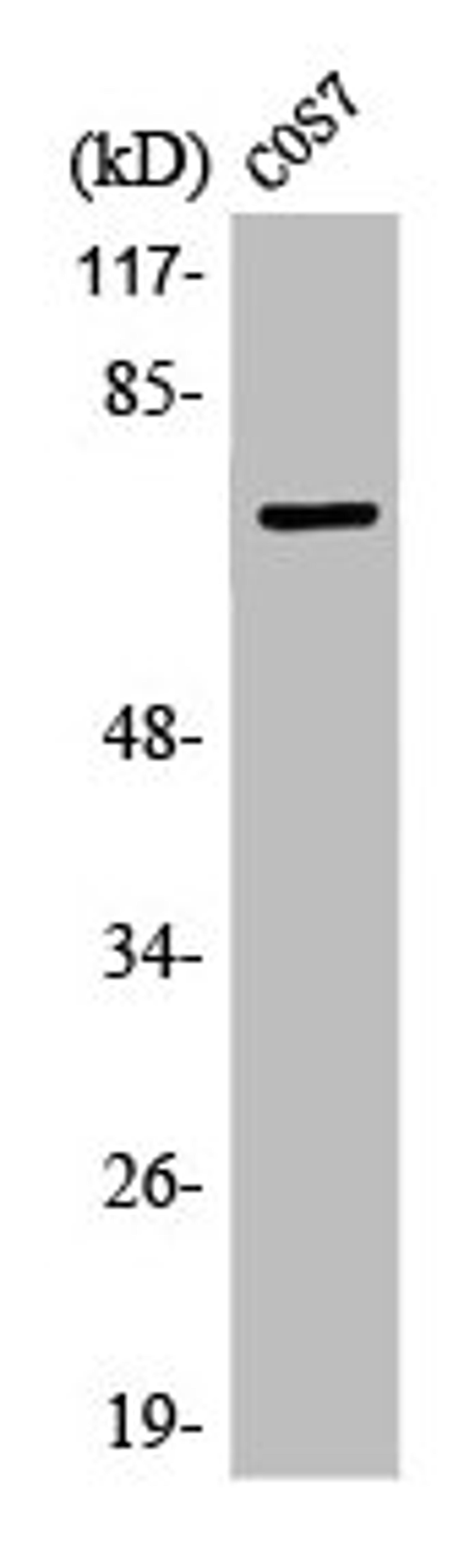 Western Blot analysis of COS7 cells using LIMK-1/2 Polyclonal Antibody