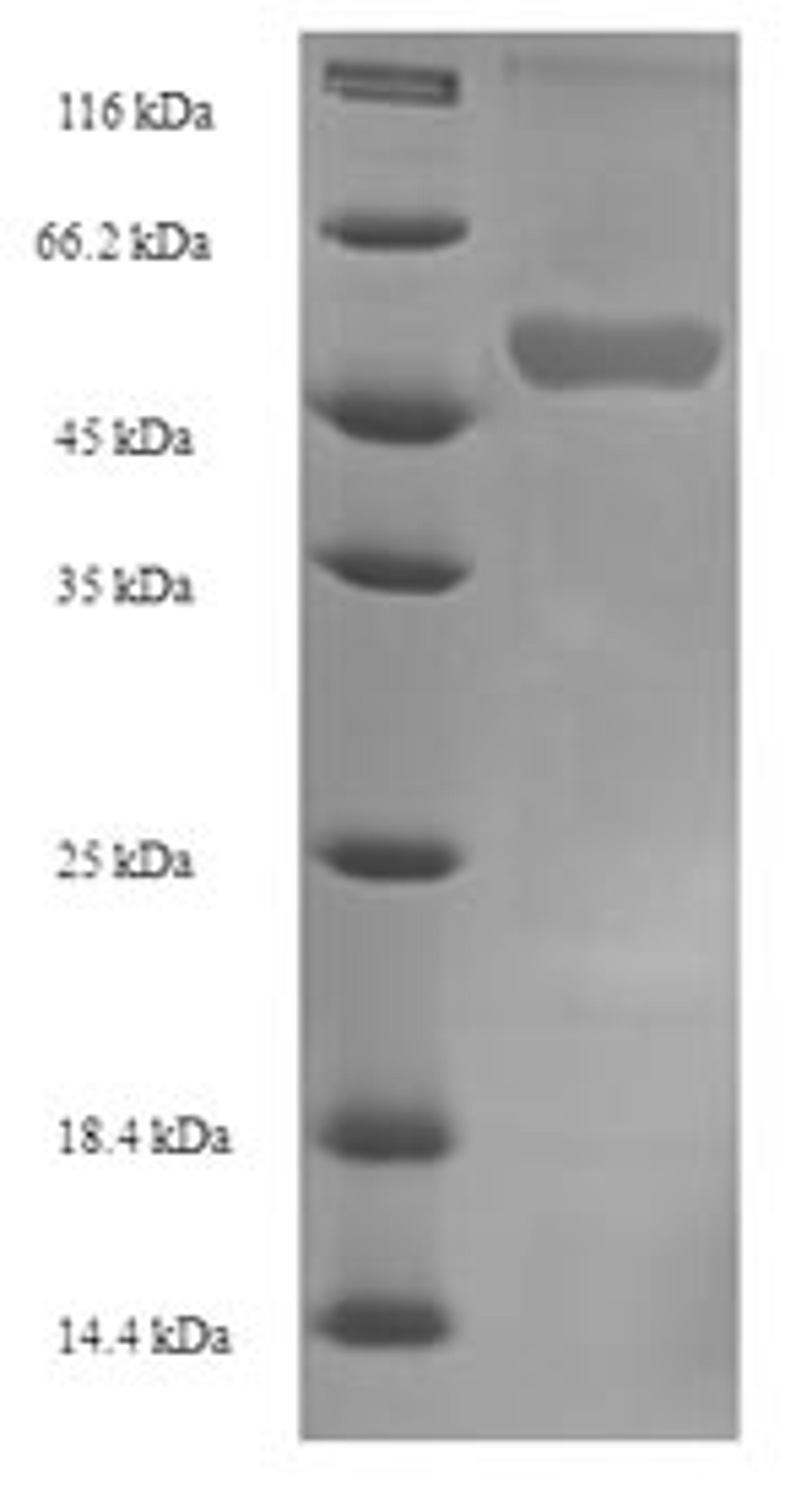 (Tris-Glycine gel) Discontinuous SDS-PAGE (reduced) with 5% enrichment gel and 15% separation gel.
