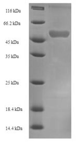(Tris-Glycine gel) Discontinuous SDS-PAGE (reduced) with 5% enrichment gel and 15% separation gel.