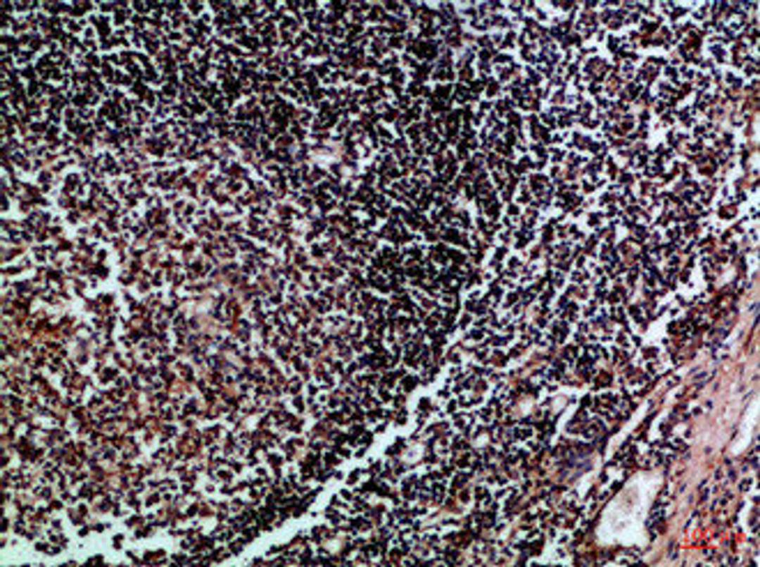 Immunohistochemical analysis of paraffin-embedded Human-tonsil, antibody was diluted at 1:100