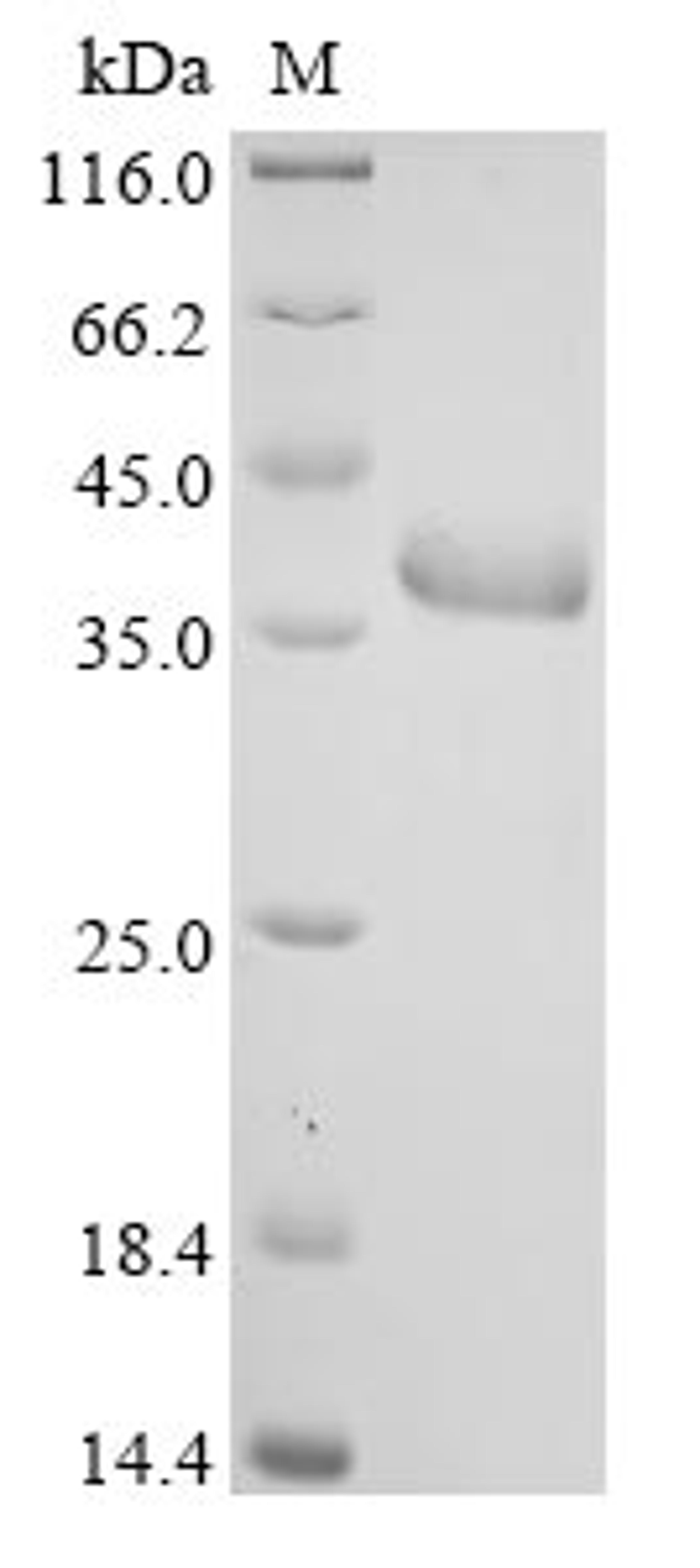 (Tris-Glycine gel) Discontinuous SDS-PAGE (reduced) with 5% enrichment gel and 15% separation gel.