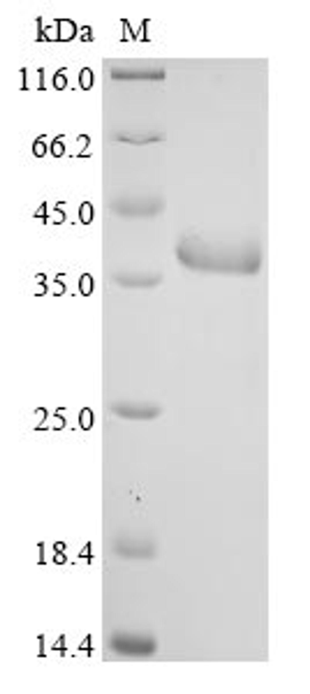 (Tris-Glycine gel) Discontinuous SDS-PAGE (reduced) with 5% enrichment gel and 15% separation gel.