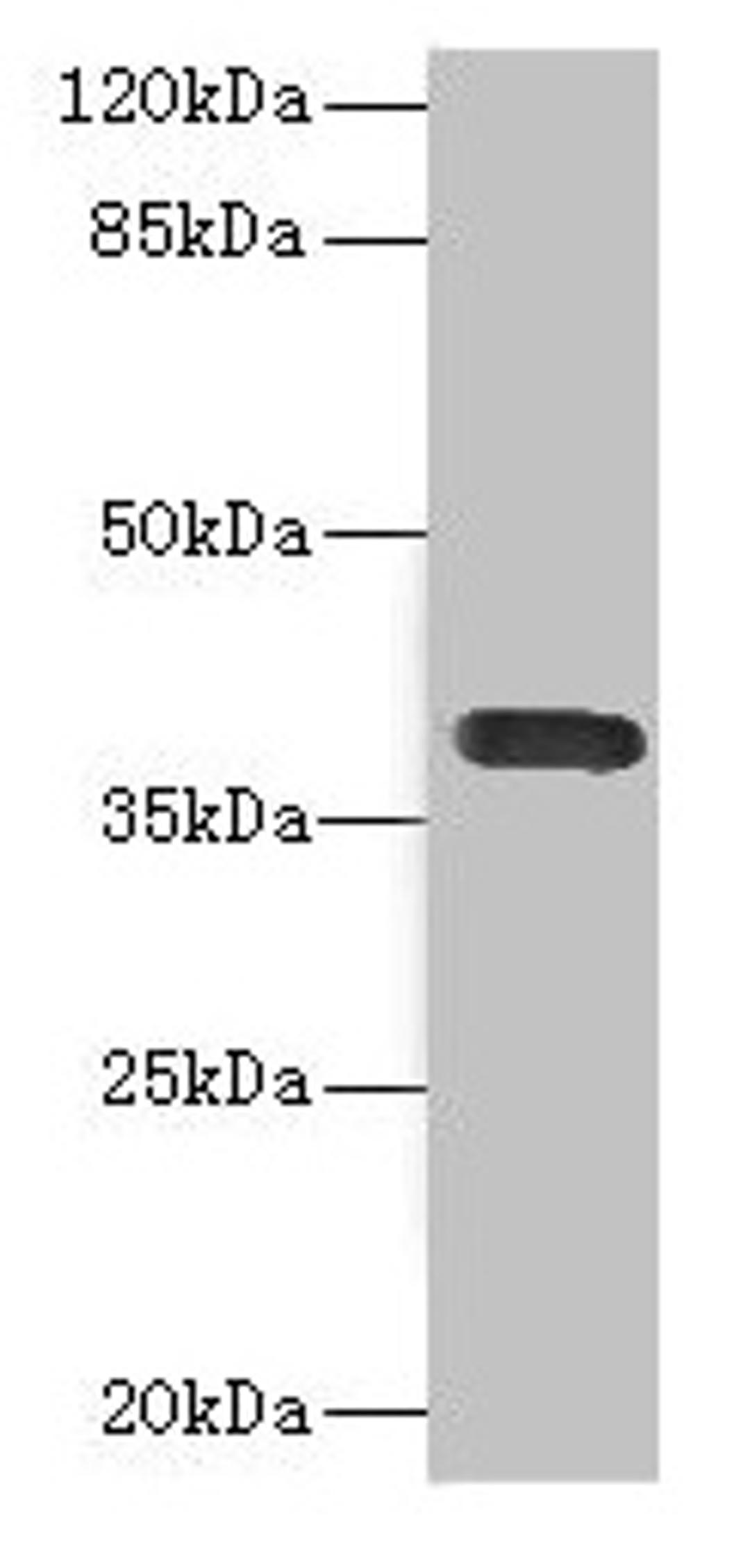Western blot. All lanes: CD226 antibody at 2.61µg/ml + A549 whole cell lysate. Secondary. Goat polyclonal to rabbit IgG at 1/10000 dilution. Predicted band size: 39 kDa. Observed band size: 39 kDa