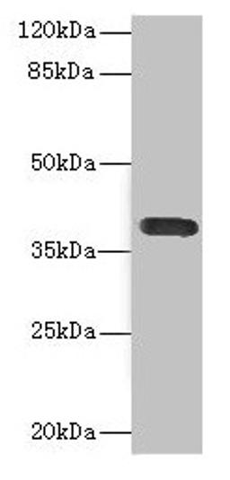 Western blot. All lanes: CD226 antibody at 2.61µg/ml + A549 whole cell lysate. Secondary. Goat polyclonal to rabbit IgG at 1/10000 dilution. Predicted band size: 39 kDa. Observed band size: 39 kDa