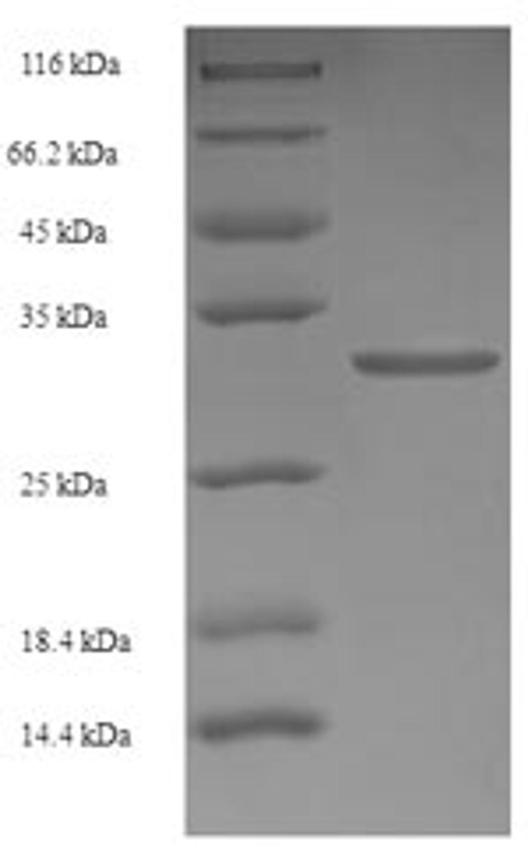 (Tris-Glycine gel) Discontinuous SDS-PAGE (reduced) with 5% enrichment gel and 15% separation gel.