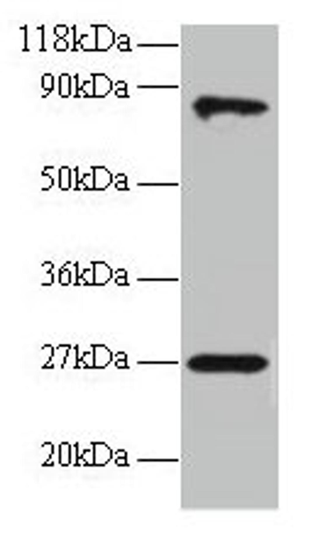 Western blot. All lanes: RPL17 antibody at 2µg/ml + EC109 whole cell lysate. Secondary. Goat polyclonal to rabbit IgG at 1/15000 dilution. Predicted band size: 22, 18, 27 kDa. Observed band size: 27, 80 kDa