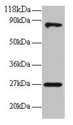 Western blot. All lanes: RPL17 antibody at 2µg/ml + EC109 whole cell lysate. Secondary. Goat polyclonal to rabbit IgG at 1/15000 dilution. Predicted band size: 22, 18, 27 kDa. Observed band size: 27, 80 kDa