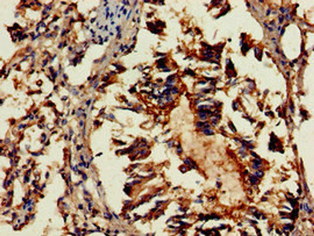 Immunohistochemistry of paraffin-embedded human lung tissue using CSB-PA892175LA01HU at dilution of 1:100