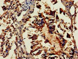 Immunohistochemistry of paraffin-embedded human lung tissue using CSB-PA892175LA01HU at dilution of 1:100