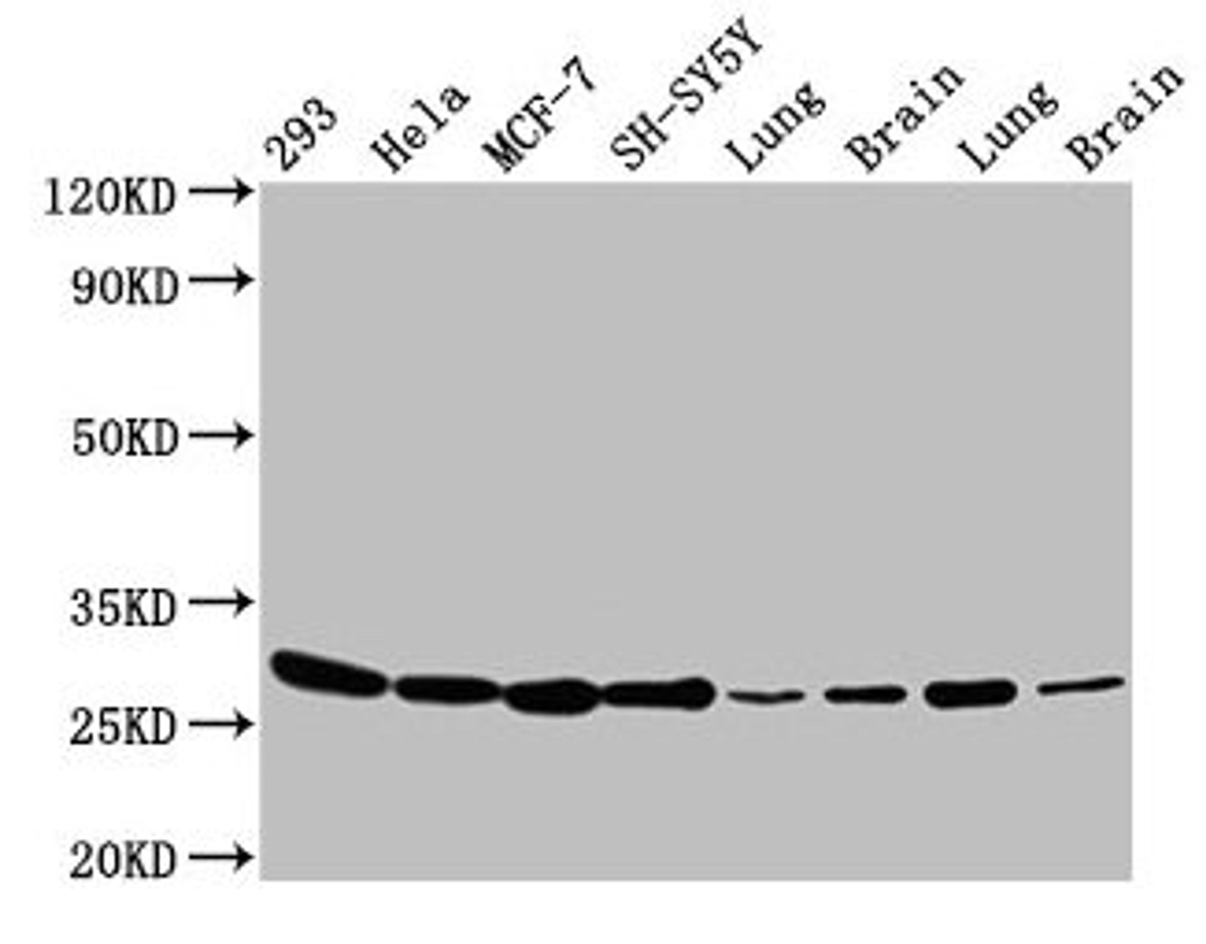 Western Blot. Positive WB detected in: 293 whole cell lysate, Hela whole cell lysate, MCF-7 whole cell lysate, SH-SY5Y whole cell lysate, Rat lung tissue, Rat brain tissue, Mouse lung tissue, Mouse brain tissue. All lanes: BCAP31 antibody at 4.8µg/ml. Secondary. Goat polyclonal to rabbit IgG at 1/50000 dilution. Predicted band size: 28, 35 kDa. Observed band size: 28 kDa