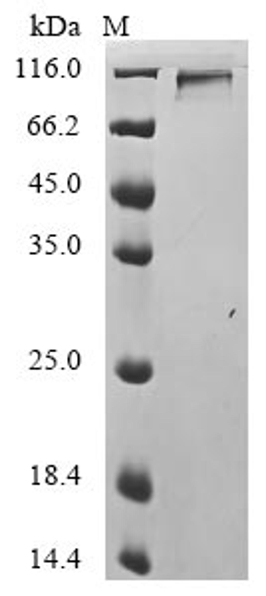 (Tris-Glycine gel) Discontinuous SDS-PAGE (reduced) with 5% enrichment gel and 15% separation gel.