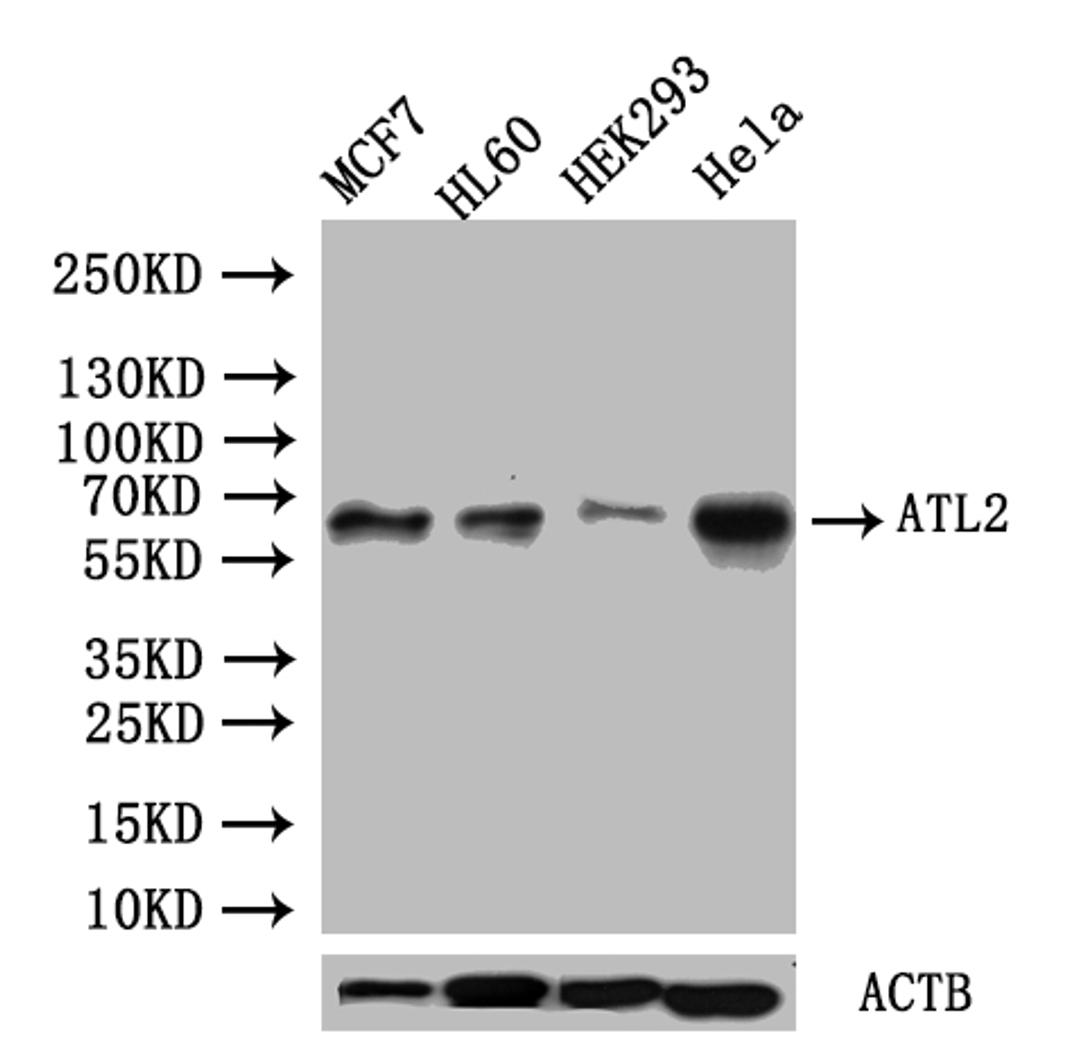 Western blot. All lanes: ATL2 antibody at 1µg/ml. Lane 1: HepG2 whole cell lysate. Lane 2: MCF-7 whole cell lysate. Lane 3: HL60 whole cell lysate. Lane 4: K562 whole cell lysate. Lane 5: U251 whole cell lysate. Lane 6: A549 whole cell lysate. Lane 7: A431 whole cell lysate. Secondary. Goat polyclonal to rabbit IgG at 1/10000 dilution. Predicted band size: 67, 47, 66, 65 kDa. Observed band size: 67 kDa