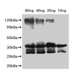 Western Blot. Positive WB detected in Recombinant protein. All lanes: Slfn9 antibody at 1:2000. Secondary. Goat polyclonal to rabbit IgG at 1/50000 dilution. Predicted band size: 36.2 kDa. Observed band size: 35 kDa. 