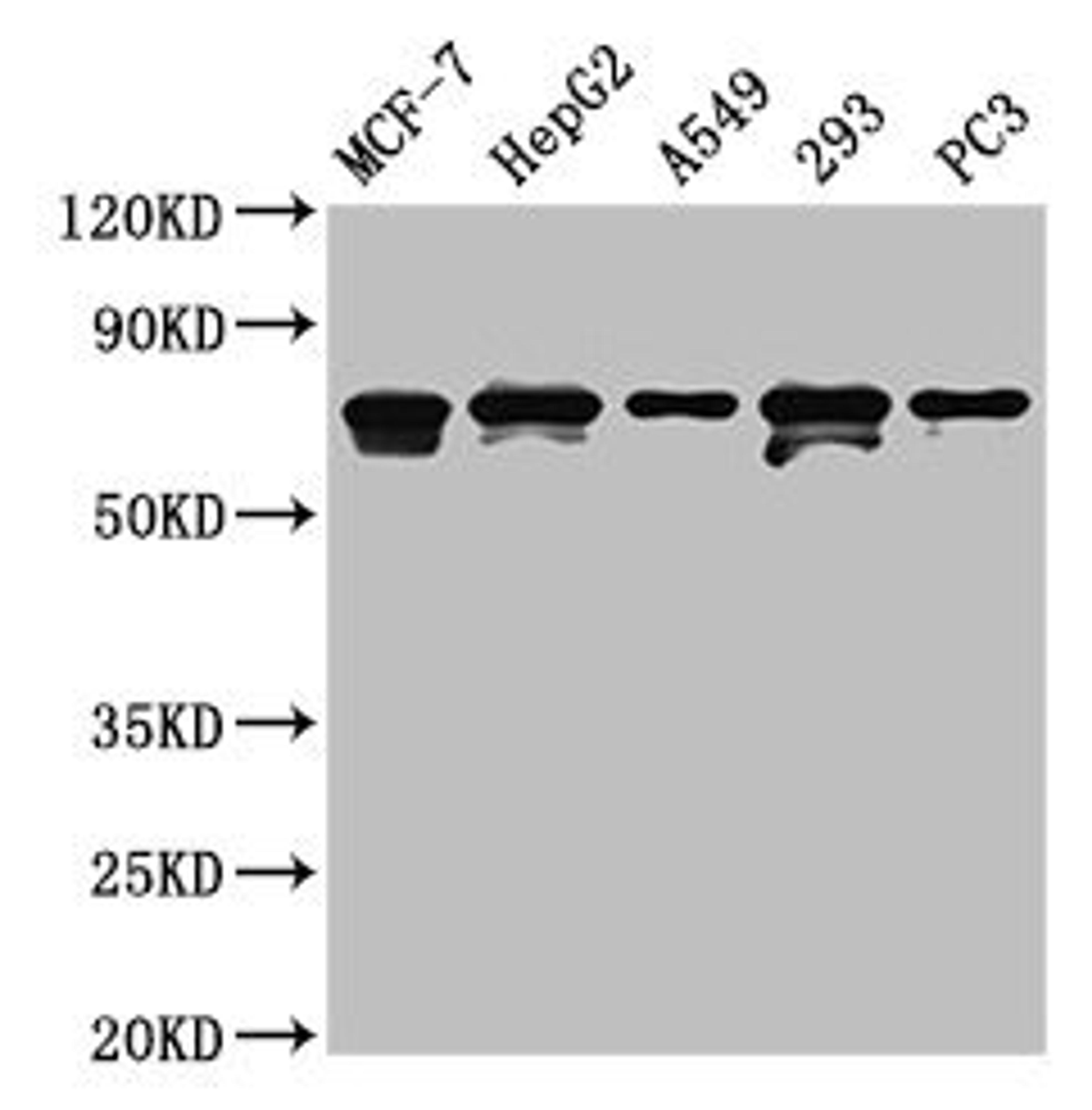 Western Blot. Positive WB detected in: MCF-7 whole cell lysate, HepG2 whole cell lysate, A549 whole cell lysate, 293 whole cell lysate, PC-3 whole cell lysate. All lanes: MAGED2 antibody at 4.5µg/ml. Secondary. Goat polyclonal to rabbit IgG at 1/50000 dilution. Predicted band size: 65, 64 kDa. Observed band size: 65, 64 kDa