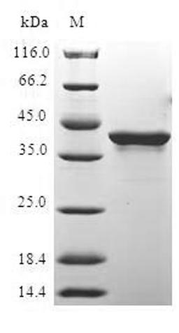 (Tris-Glycine gel) Discontinuous SDS-PAGE (reduced) with 5% enrichment gel and 15% separation gel.