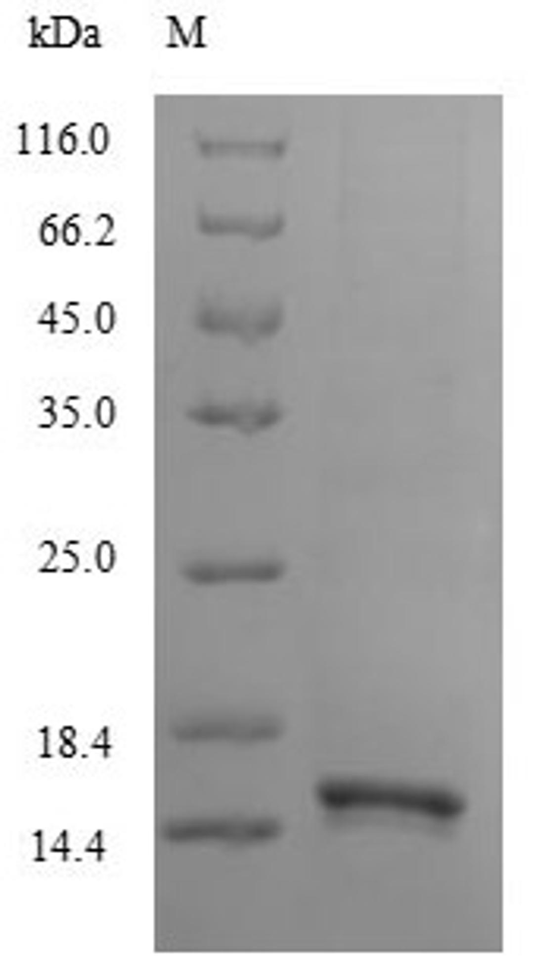 (Tris-Glycine gel) Discontinuous SDS-PAGE (reduced) with 5% enrichment gel and 15% separation gel.