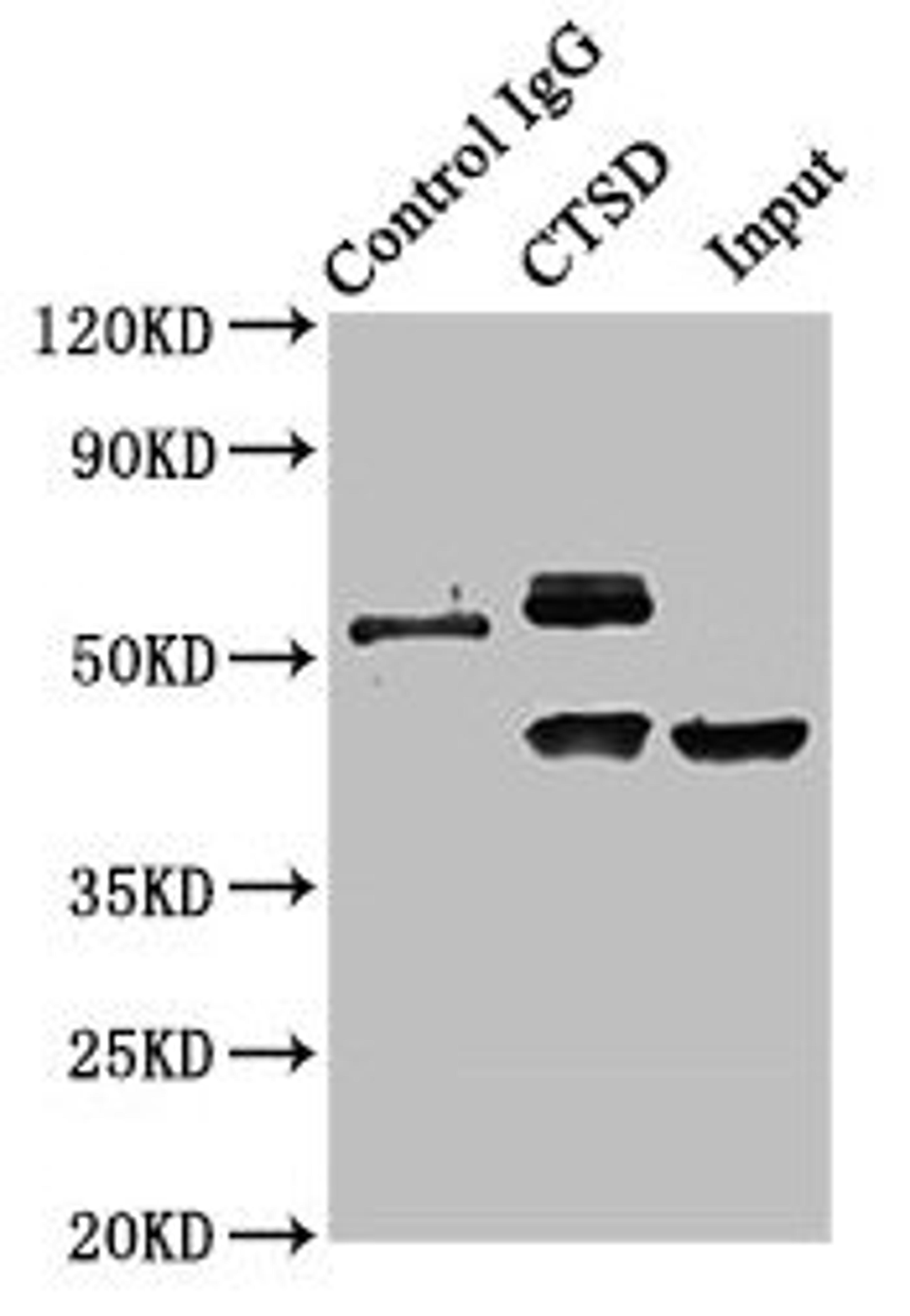 Immunoprecipitating CTSD in HepG2 whole cell lysate. Lane 1: Rabbit control IgG instead of CSB-PA02129A0Rb in HepG2 whole cell lysate. For western blotting, a HRP-conjugated Protein G antibody was used as the secondary antibody (1/2000). Lane 2: CSB-PA02129A0Rb (8µg) + HepG2 whole cell lysate (500µg). Lane 3: HepG2 whole cell lysate (10µg)