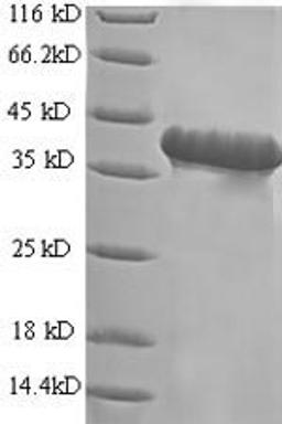 (Tris-Glycine gel) Discontinuous SDS-PAGE (reduced) with 5% enrichment gel and 15% separation gel.