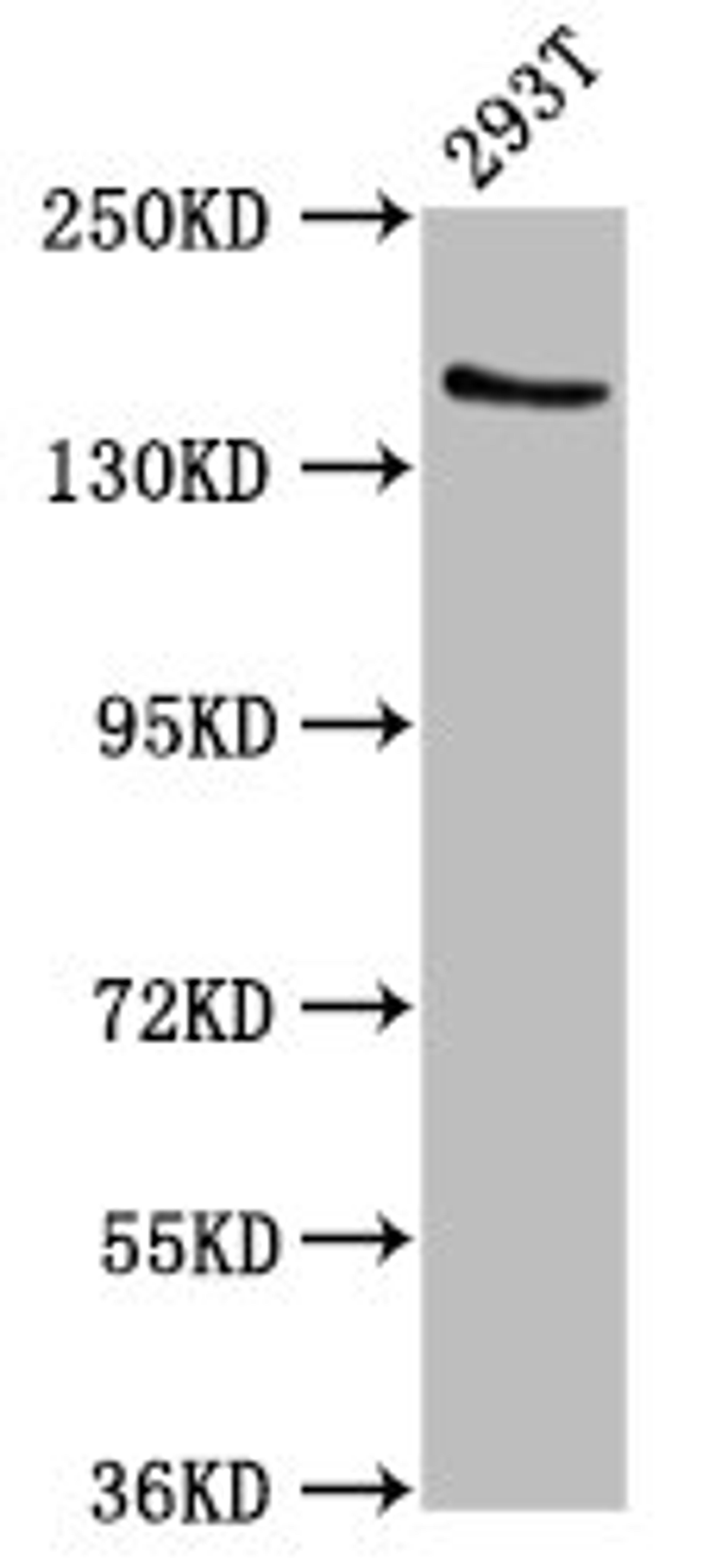 Western Blot. Positive WB detected in: 293T whole cell lysate. All lanes: EPRS antibody at 7.4ug/ml. Secondary. Goat polyclonal to rabbit IgG at 1/50000 dilution. Predicted band size: 171 kDa. Observed band size: 171 kDa. 