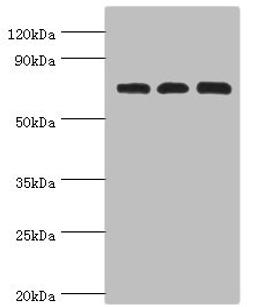 Western blot. All lanes: Calcium-binding mitochondrial carrier protein Aralar2 antibody at 4ug/ml. Lane 1: Mouse liver tissue. Lane 2: Mouse kidney tissue. Lane 2: HepG2 whole cell lysate. Secondary. Goat polyclonal to rabbit IgG at 1/10000 dilution. Predicted band size: 74 kDa. Observed band size: 74 kDa. 