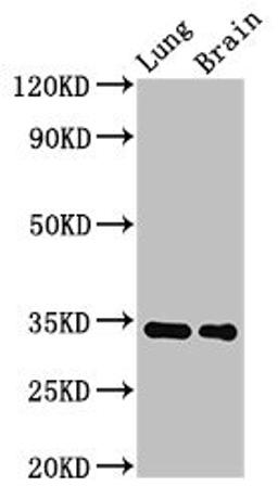 Western Blot. Positive WB detected in: Rat lung tissue, Mouse brain tissue. All lanes: Mgll antibody at 2.8µg/ml. Secondary. Goat polyclonal to rabbit IgG at 1/50000 dilution. Predicted band size: 34 kDa. Observed band size: 34 kDa