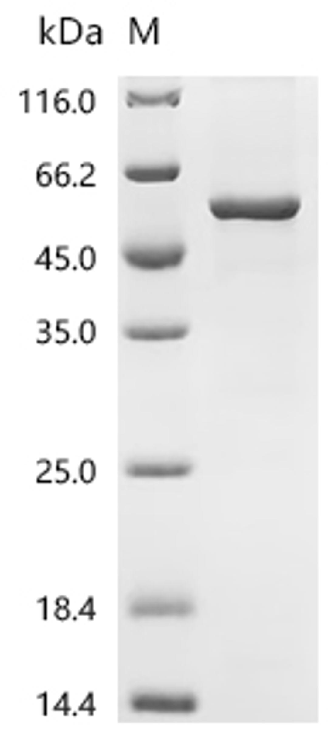 (Tris-Glycine gel) Discontinuous SDS-PAGE (reduced) with 5% enrichment gel and 15% separation gel.