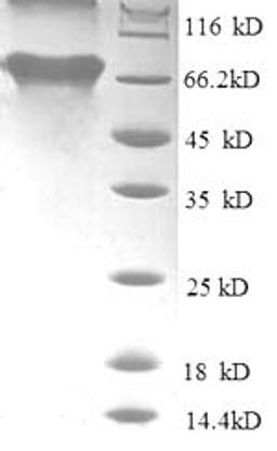 (Tris-Glycine gel) Discontinuous SDS-PAGE (reduced) with 5% enrichment gel and 15% separation gel.