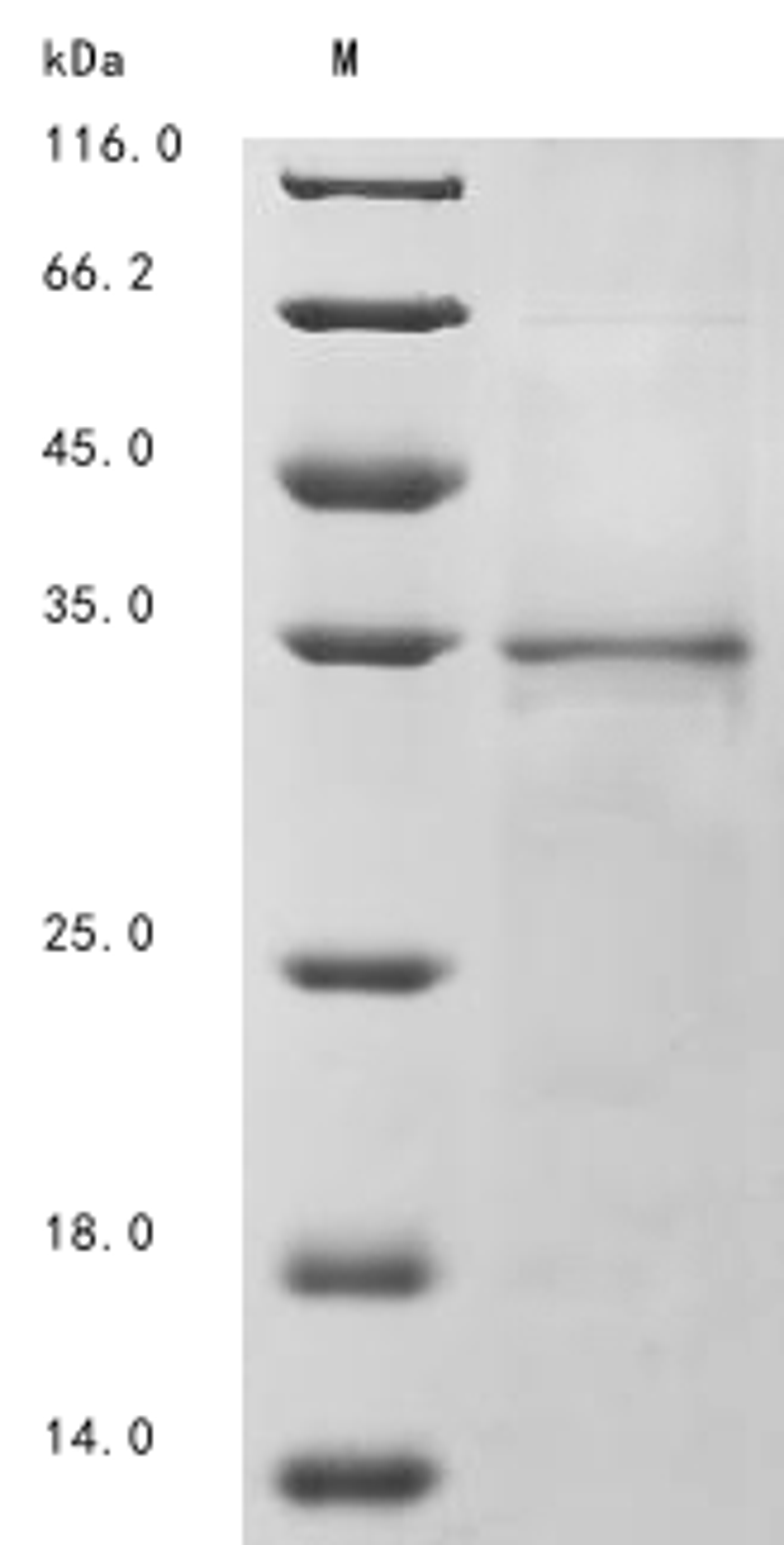 (Tris-Glycine gel) Discontinuous SDS-PAGE (reduced) with 5% enrichment gel and 15% separation gel.