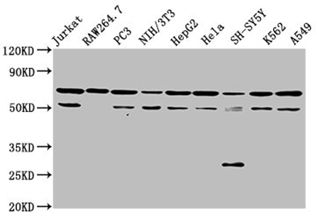 Western Blot. Positive WB detected in: Jurkat whole cell lysate, RAW264.7 whole cell lysate, PC-3 whole cell lysate, NIH/3T3 whole cell lysate, HepG2 whole cell lysate, Hela whole cell lysate, SH-SY5Y whole cell lysate, K562 whole cell lysate, A549 whole cell lysate. All lanes: NUP62 antibody at 3.5ug/ml. Secondary. Goat polyclonal to rabbit IgG at 1/50000 dilution. Predicted band size: 54 kDa. Observed band size: 62 kDa. 