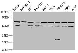 Western Blot. Positive WB detected in: Jurkat whole cell lysate, RAW264.7 whole cell lysate, PC-3 whole cell lysate, NIH/3T3 whole cell lysate, HepG2 whole cell lysate, Hela whole cell lysate, SH-SY5Y whole cell lysate, K562 whole cell lysate, A549 whole cell lysate. All lanes: NUP62 antibody at 3.5ug/ml. Secondary. Goat polyclonal to rabbit IgG at 1/50000 dilution. Predicted band size: 54 kDa. Observed band size: 62 kDa.