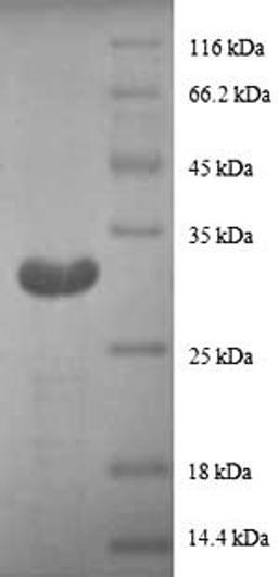 (Tris-Glycine gel) Discontinuous SDS-PAGE (reduced) with 5% enrichment gel and 15% separation gel.