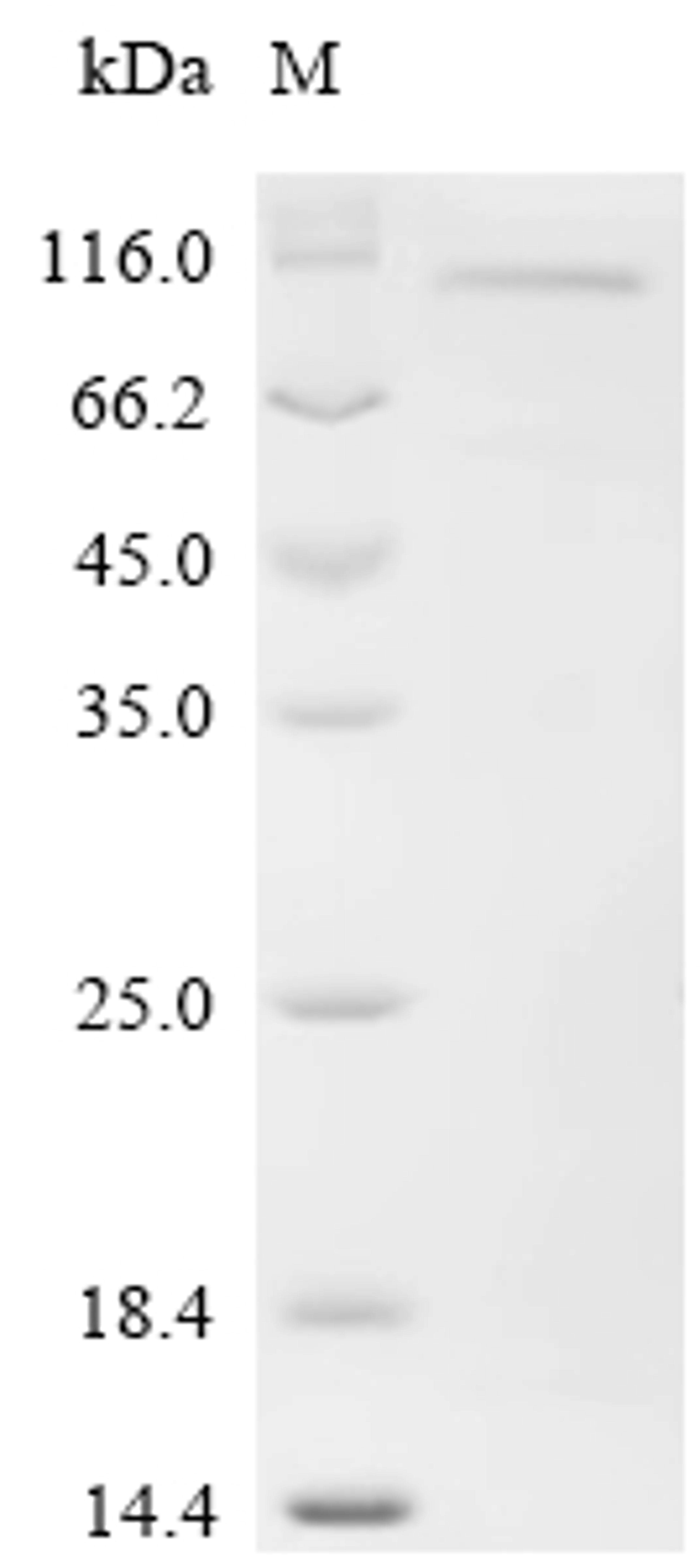 (Tris-Glycine gel) Discontinuous SDS-PAGE (reduced) with 5% enrichment gel and 15% separation gel.