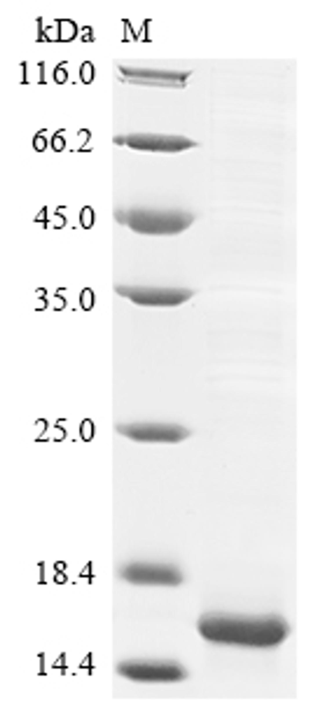 (Tris-Glycine gel) Discontinuous SDS-PAGE (reduced) with 5% enrichment gel and 15% separation gel.