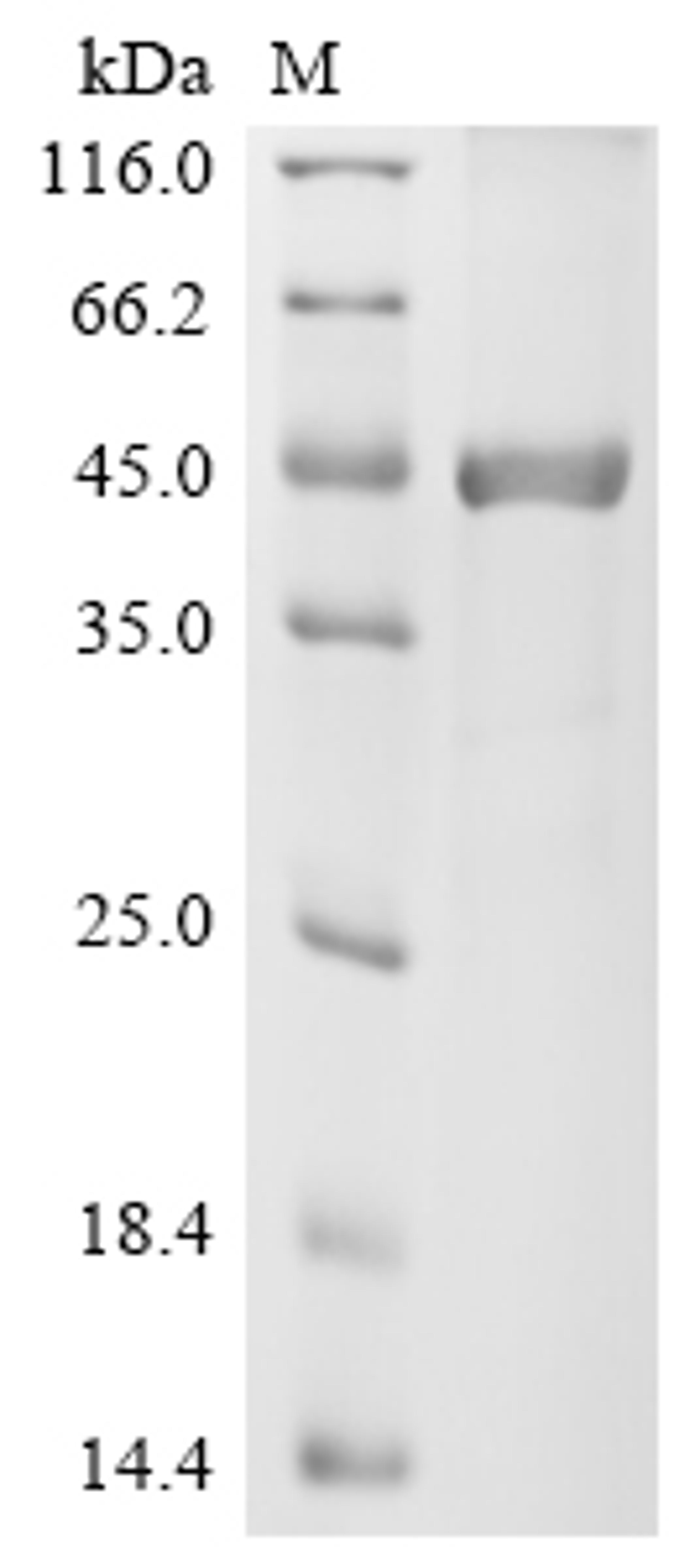 (Tris-Glycine gel) Discontinuous SDS-PAGE (reduced) with 5% enrichment gel and 15% separation gel.