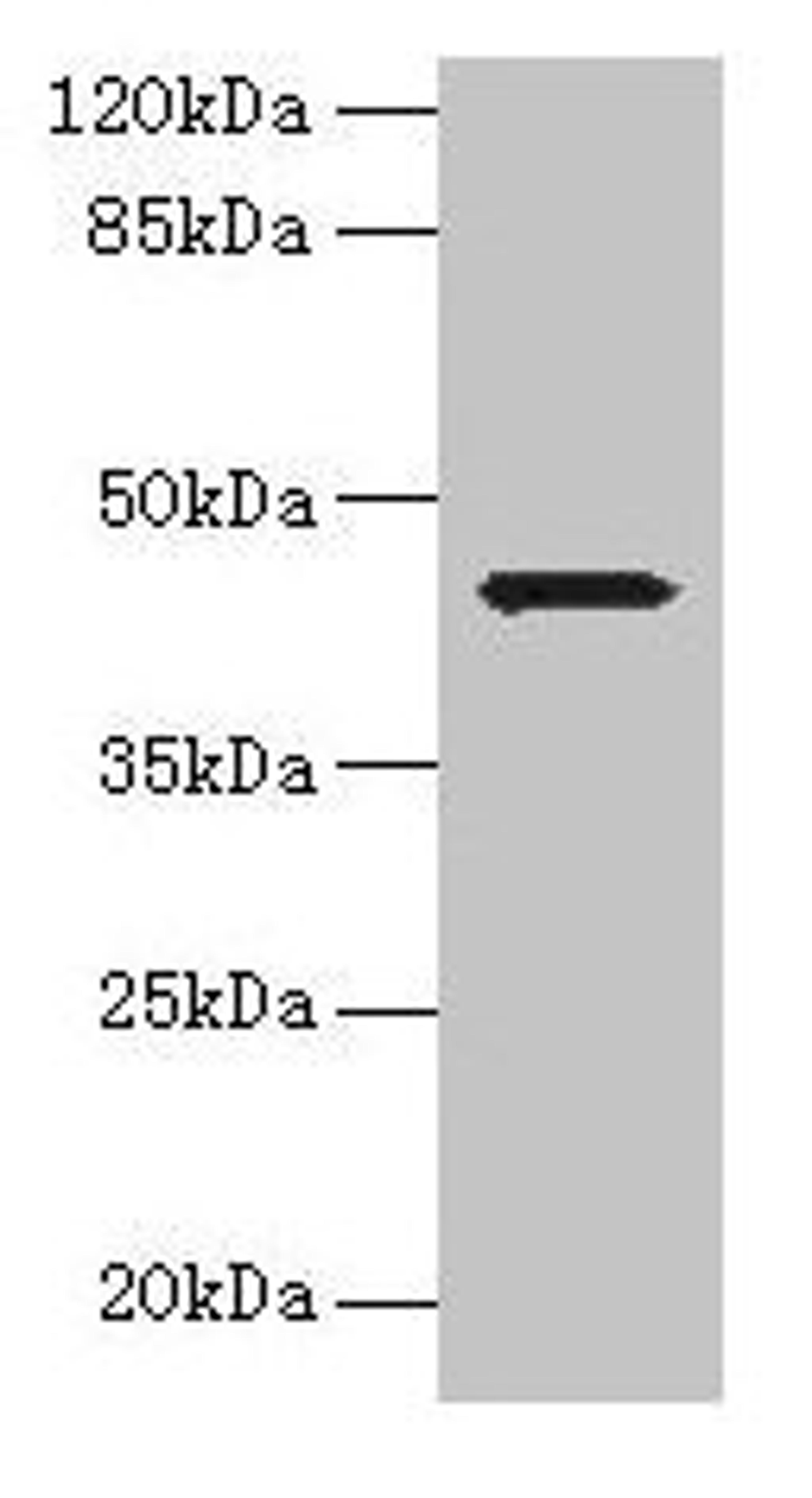 Western blot. All lanes: WDR74 antibody at 0.5µg/ml + Hela whole cell lysate. Secondary. Goat polyclonal to rabbit IgG at 1/10000 dilution. Predicted band size: 43, 41 kDa. Observed band size: 43 kDa